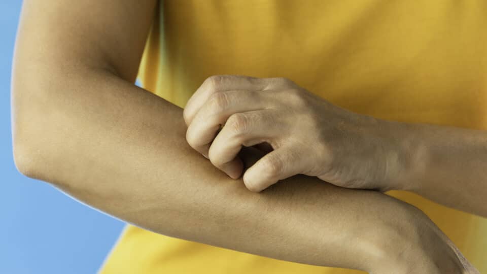 Scratching