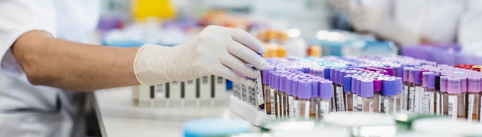 Laboratory tech handling samples.