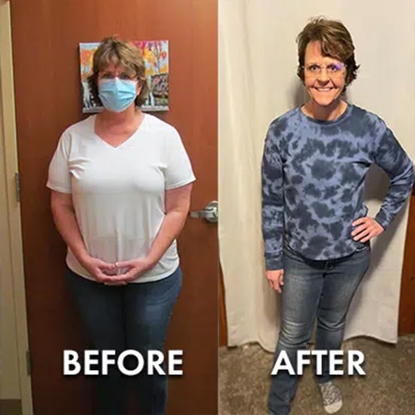 Before After Paula