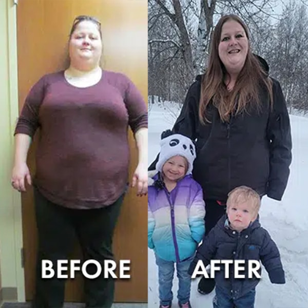 Diannehamiltonbeforeafter