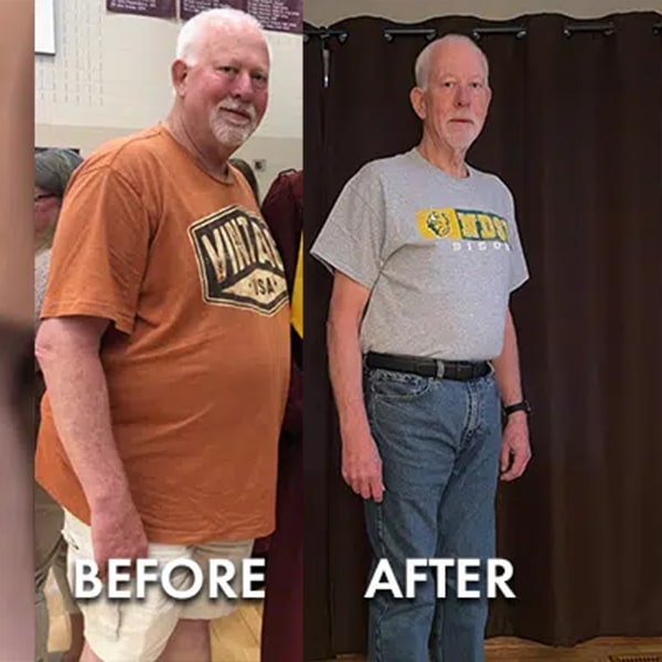 Garybeforeafter