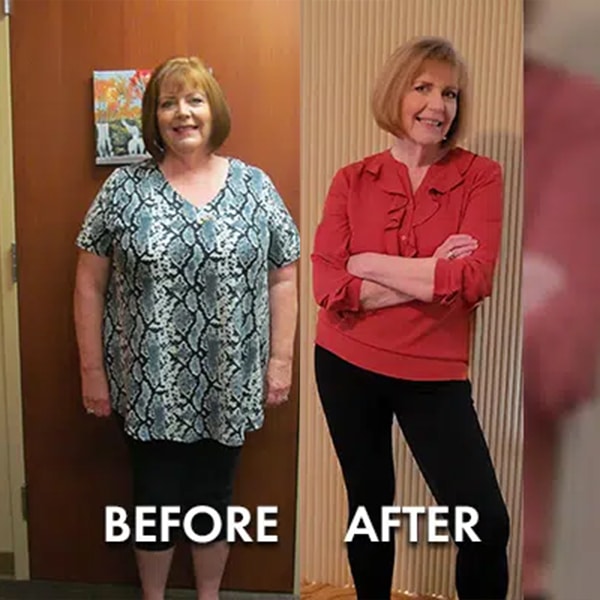 Ladonna K Before After