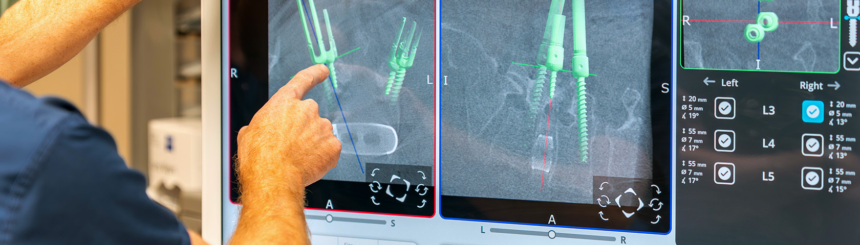 CRMC Leads the Way in Assisted Robotic Spine Surgery