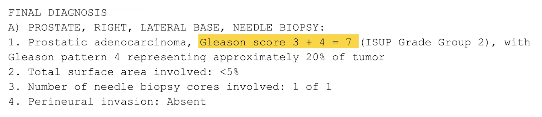 Gleason Score Crmc Urology