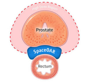 With Space Oar Hydrogel